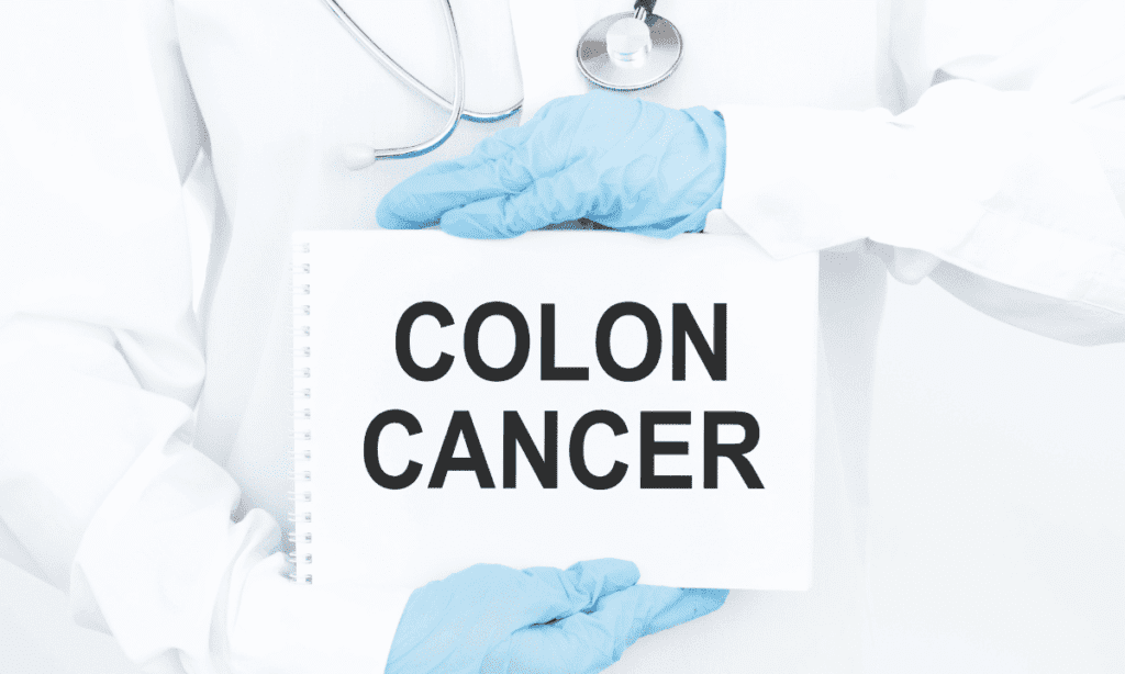 Signs of Colon Cancer